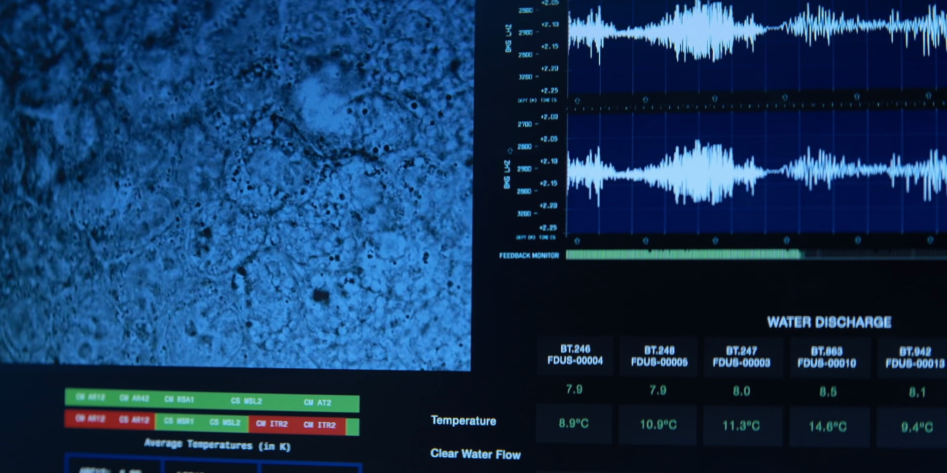 Cancerous Cell Growth Monitoring Interface – The Lost Symbol S01E01