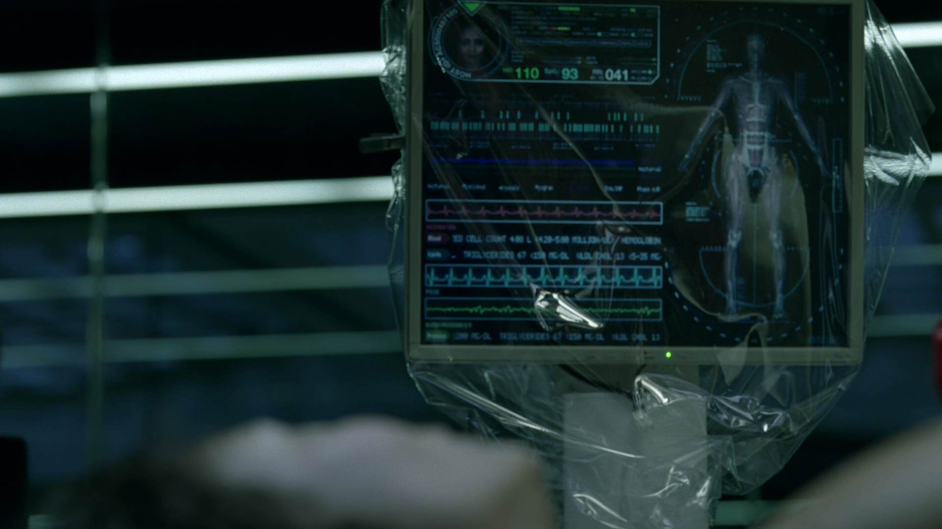 Medical display – Westworld S01E02