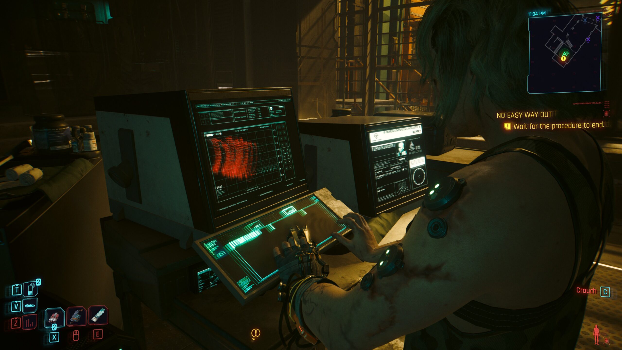 Medical Procedure Monitoring – Cyberpunk 2077